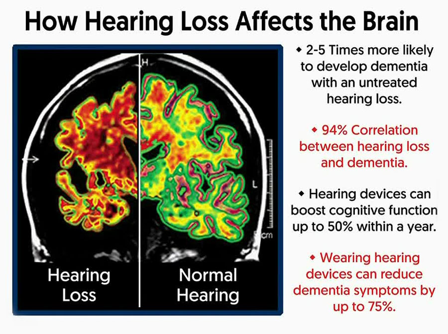 Brain Data